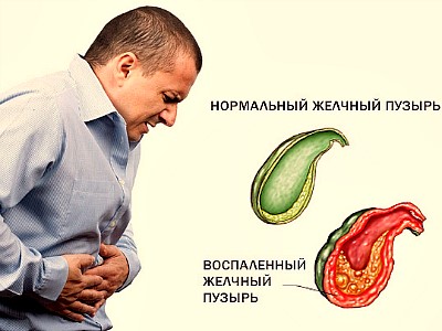 Можно ли пить Аллохол при панкреатите: состав, инструкция и противопоказания Можно ли пить Аллохол при панкреатите: состав, инструкция и противопоказания