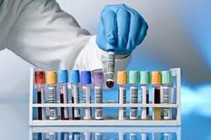 Нормальный уровень АЛТ и АСТ у взрослых Нормальный уровень АЛТ и АСТ у взрослых