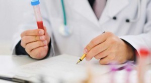 Изменение АЛТ и АСТ при гепатите С Изменение АЛТ и АСТ при гепатите С