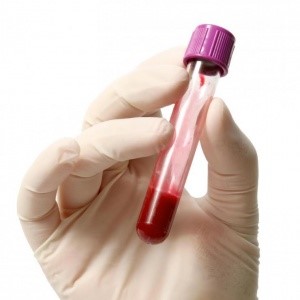 Амилаза панкреатическая, что это за медицинский термин? Амилаза панкреатическая, что это за медицинский термин?