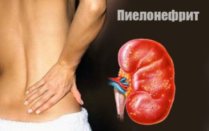 Резкая боль в левом боку со спины Резкая боль в левом боку со спины