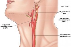 Болит челюстной сустав: лечение челюсти, причины болей Болит челюстной сустав: лечение челюсти, причины болей