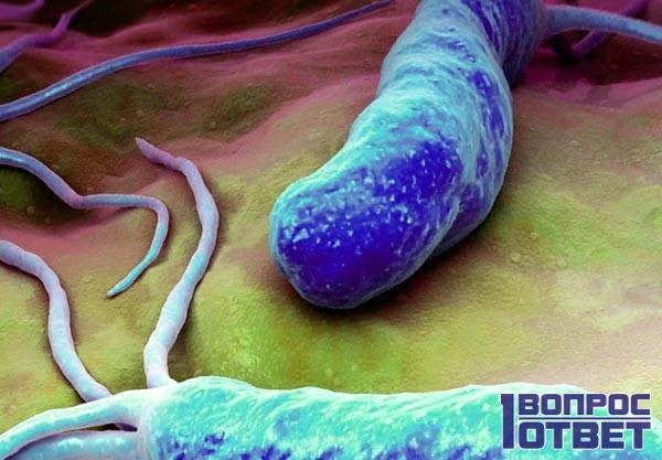 Что такое бульбит желудка? Что такое бульбит желудка?