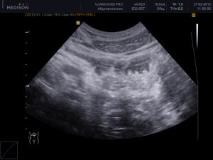 Особенности УЗИ желудка Особенности УЗИ желудка