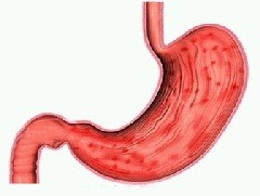 Как проявляется и лечится гастрит эритематозный? Как проявляется и лечится гастрит эритематозный?