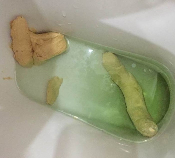 Почему появляется кал светло-желтого цвета? Почему появляется кал светло-желтого цвета?