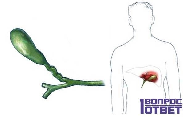 Правильные способы лечения деформации желчного пузыря Правильные способы лечения деформации желчного пузыря