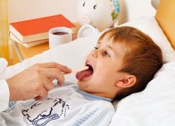 Прививка от скарлатины: когда делают детям Прививка от скарлатины: когда делают детям