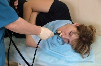 Дуоденальный рефлюкс-гастрит Дуоденальный рефлюкс-гастрит