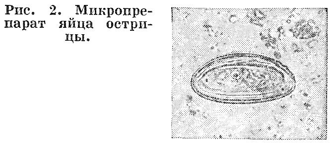 Как происходит заражение человека острицами? Как происходит заражение человека острицами?