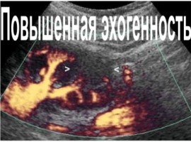 Высокий показатель эхогенности печени: причины, симптомы и лечение Высокий показатель эхогенности печени: причины, симптомы и лечение