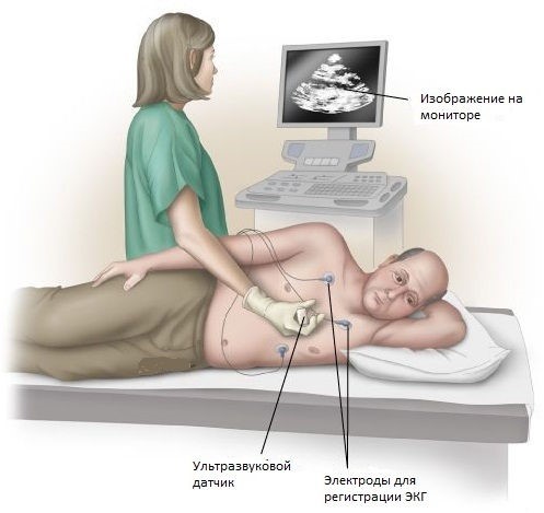 Что выбрать для сердца - ультразвук или электрокардиографию? Что выбрать для сердца - ультразвук или электрокардиографию?