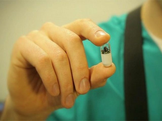 Особенности гастроскопии желудка без глотания зонда Особенности гастроскопии желудка без глотания зонда