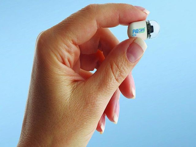 Особенности гастроскопии желудка без глотания зонда Особенности гастроскопии желудка без глотания зонда