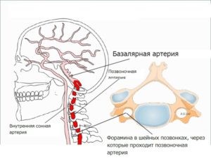 Особенности гипоплазии позвоночных артерий (правой и левой) Особенности гипоплазии позвоночных артерий (правой и левой)