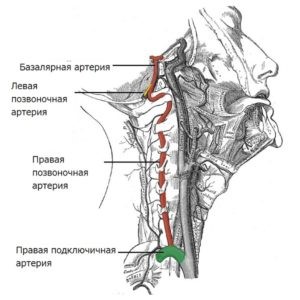 Особенности гипоплазии позвоночных артерий (правой и левой) Особенности гипоплазии позвоночных артерий (правой и левой)