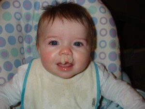 Как лечить зеленые сопли: причины возникновения зеленых соплей Как лечить зеленые сопли: причины возникновения зеленых соплей