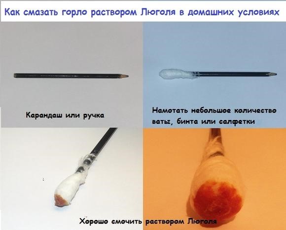 Отзывы и инструкция по применению раствора Люголь с глицерином Отзывы и инструкция по применению раствора Люголь с глицерином