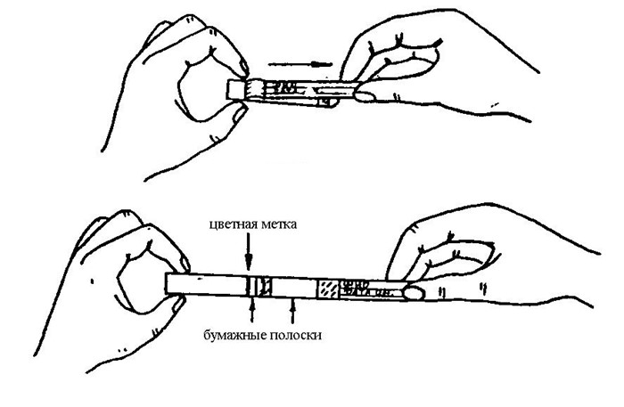 Как берется соскоб на энтеробиоз? Как берется соскоб на энтеробиоз?