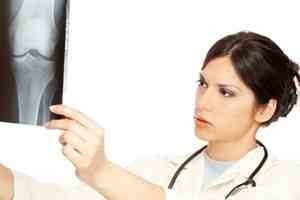 Препараты для сращивания и укрепления костей при переломах Препараты для сращивания и укрепления костей при переломах