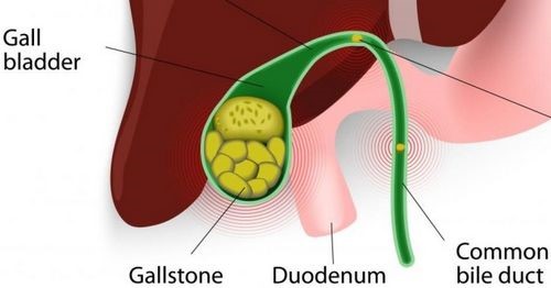 Заброс желчи в желудок: причины и методы лечения Заброс желчи в желудок: причины и методы лечения