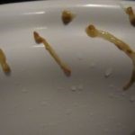 Как выходят гельминты у человека после курса терапии? Как выходят гельминты у человека после курса терапии?