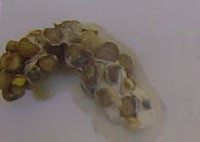 Что означает появление белого кала? Что означает появление белого кала?