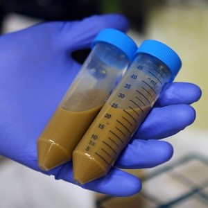 Что делать, если кал с кровью: основные причины патологии Что делать, если кал с кровью: основные причины патологии