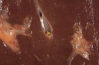 Кальциноз печени: причины, симптомы, профилактика Кальциноз печени: причины, симптомы, профилактика