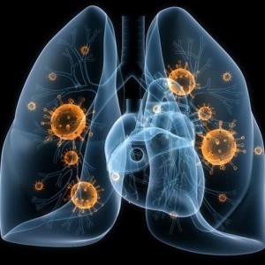 Klebsiella pneumonia (клебсиелла) в моче Klebsiella pneumonia (клебсиелла) в моче