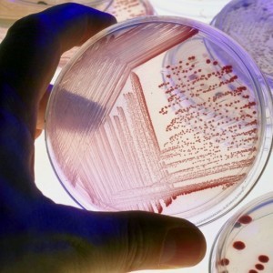 Klebsiella pneumonia (клебсиелла) в моче Klebsiella pneumonia (клебсиелла) в моче