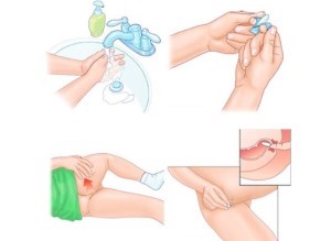 Какие мази, свечи и таблетки помогают при лечении геморроя лучше Какие мази, свечи и таблетки помогают при лечении геморроя лучше