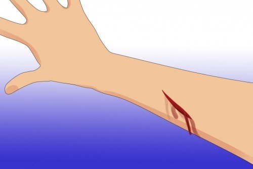 Лечение сахарного диабета 2 типа содой: как пить (принимать) Лечение сахарного диабета 2 типа содой: как пить (принимать)