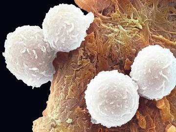 Содержание лейкоцитов в крови при беременности Содержание лейкоцитов в крови при беременности