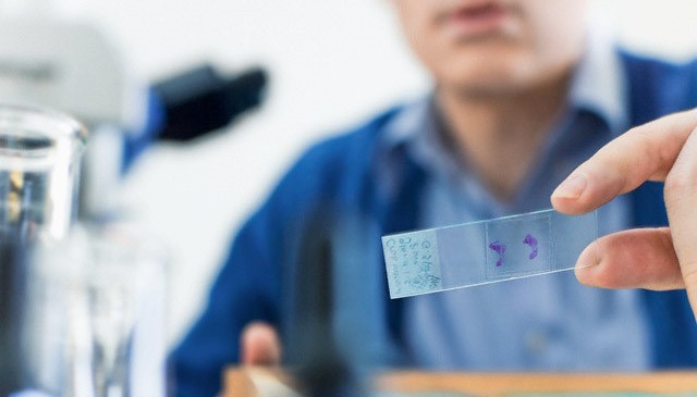 Что такое лимфома? Что такое лимфома?