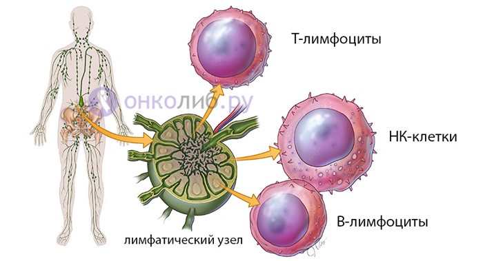 Что такое лимфома? Что такое лимфома?