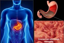 Можно ли есть молочный и горький шоколад при гастритах? Можно ли есть молочный и горький шоколад при гастритах?
