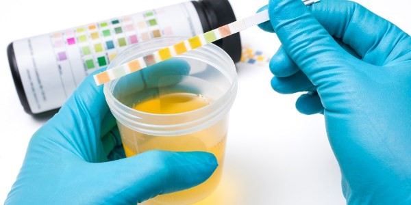 Какая норма лейкоцитов в моче и что делать, если показатели отклоняются от нормы Какая норма лейкоцитов в моче и что делать, если показатели отклоняются от нормы