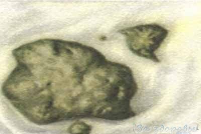 Какой цвет должен быть у кала? Какой цвет должен быть у кала?