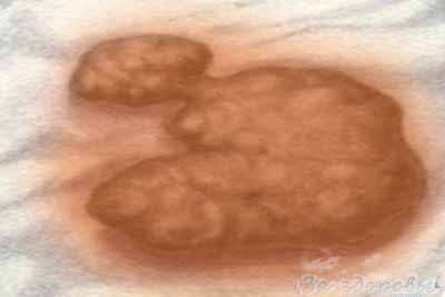 Какой цвет должен быть у кала? Какой цвет должен быть у кала?