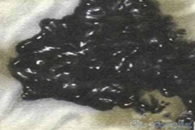 Какой цвет должен быть у кала? Какой цвет должен быть у кала?