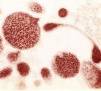 Офлоксацин: показания, инструкция по применению, отзывы, аналоги Офлоксацин: показания, инструкция по применению, отзывы, аналоги