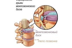 Почему болит живот под ребрами? Самые распространенные причины Почему болит живот под ребрами? Самые распространенные причины