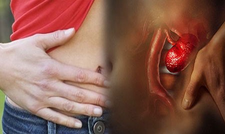 Опущение почки: симптомы, причины и последствия Опущение почки: симптомы, причины и последствия