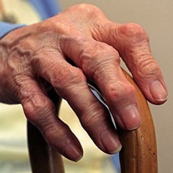 Остеоартроз локтевого сустава 1 и 2 степени: лечение ДОА Остеоартроз локтевого сустава 1 и 2 степени: лечение ДОА