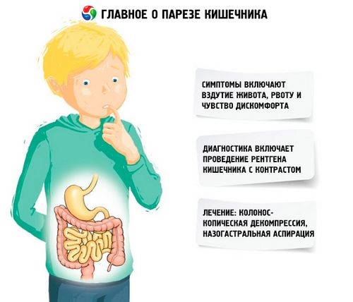 Как можно вылечить парез кишечника? Как можно вылечить парез кишечника?