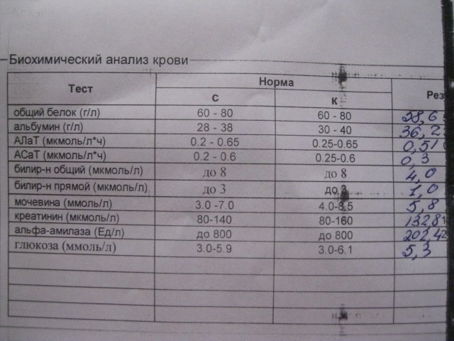 Печеночные пробы: расшифровка показателей, норма Печеночные пробы: расшифровка показателей, норма