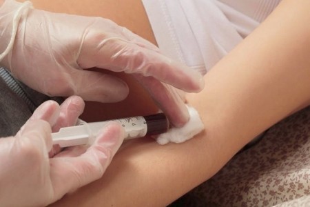 Анализ крови на трансаминазу Анализ крови на трансаминазу