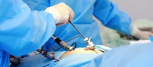 Осложнение кисты яичника: перекрут ножки Осложнение кисты яичника: перекрут ножки