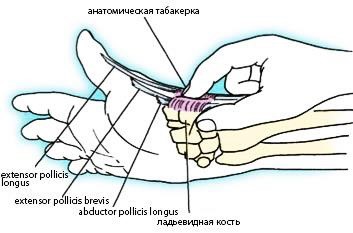 Причины, лечение и восстановление перелома ладьевидной кости кисти Причины, лечение и восстановление перелома ладьевидной кости кисти